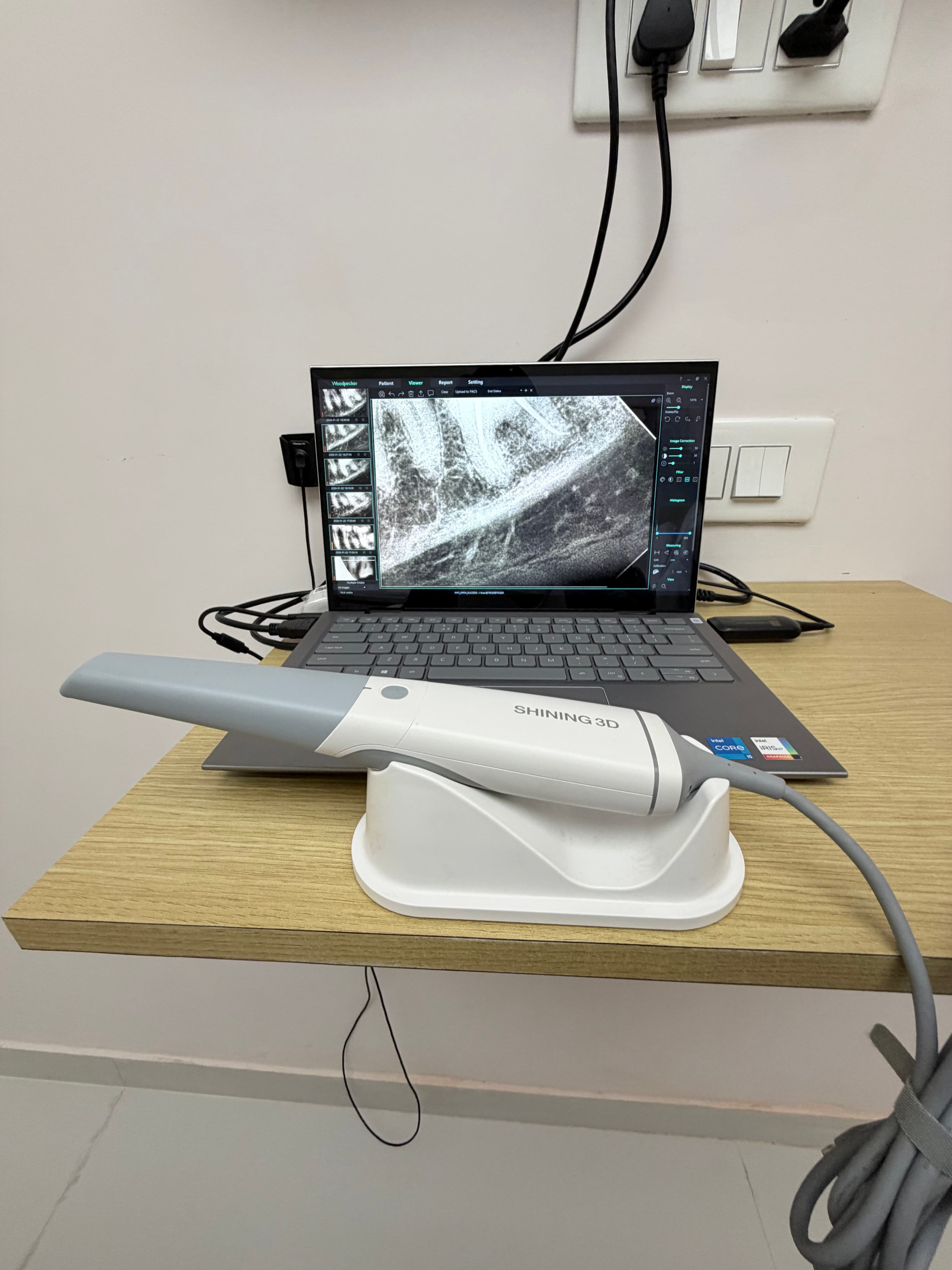 Intra Oral Scanner