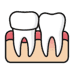 Crown & Bridges