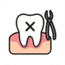 Tooth Extraction